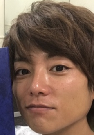 加齢によるまぶたの老化現象?