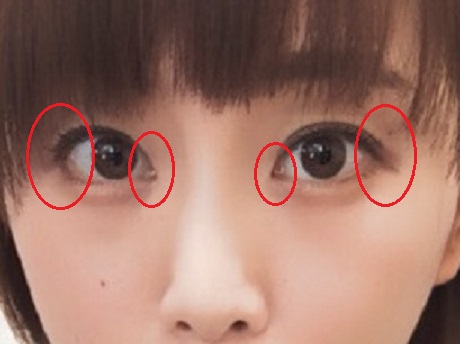 松井玲奈整形で目頭と目尻切開?目の形が違う!