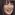 高梨臨の顔はあごと歯を整形して変わった？何かが違う！
